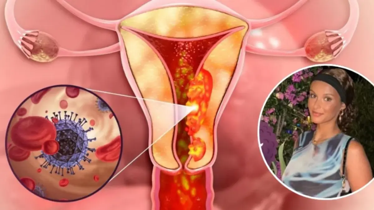 Meses de síntomas ignorados: estudiante relata cómo tumor con cabello y dientes cambió su vida