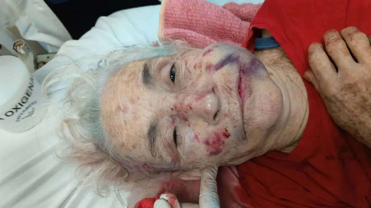 Hombre golpea brutalmente a su ex suegra porque su ex pareja no quiere volver con él