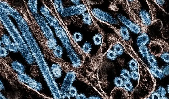 California declara emergencia por gripe aviar. ¿Qué tan grave es la situación?