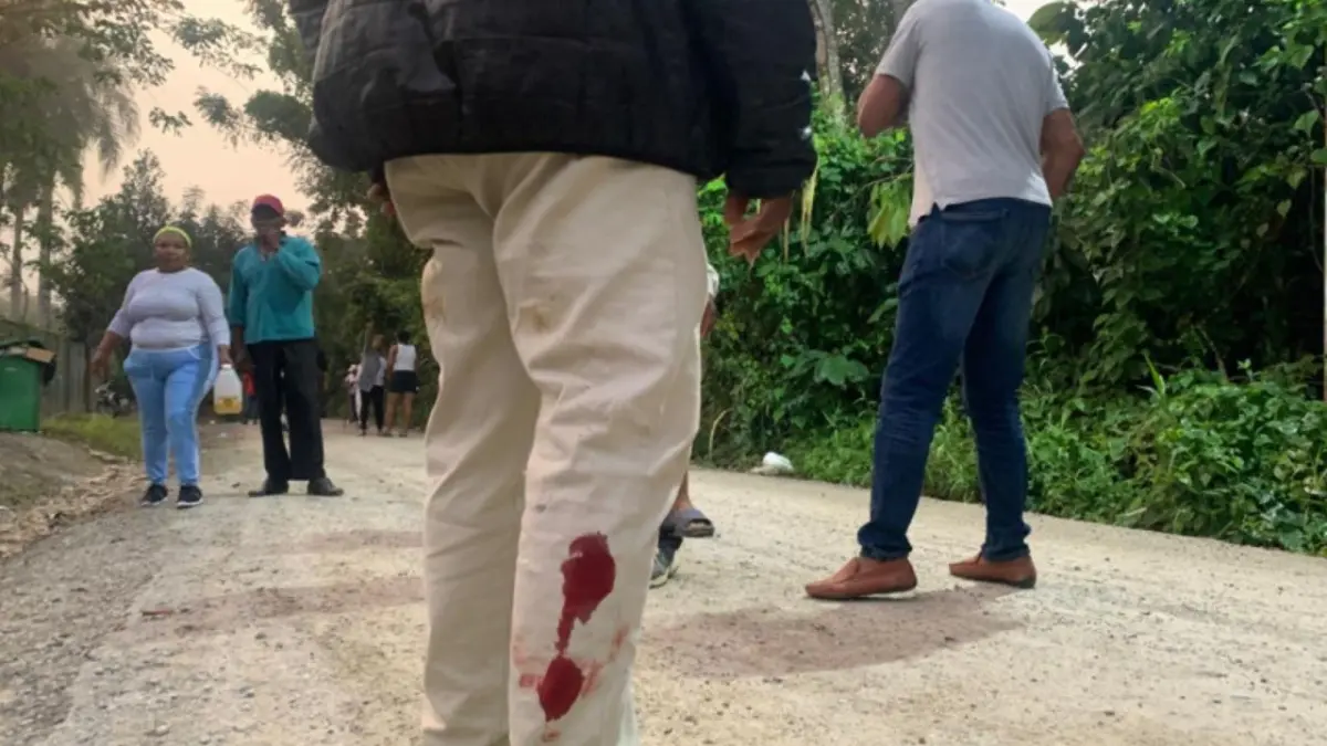 Cura herido en protesta vinculada a la Barrick dice que si policía niega que un miembro lo agredió, quisiera que le muestren video