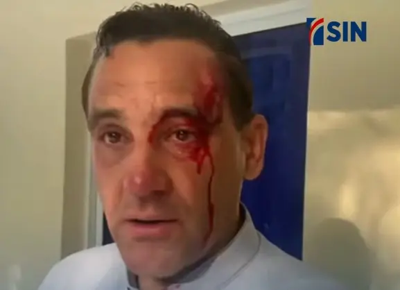 Efectivos del Ejército golpean al sacerdote Johnny Duran; responsabiliza al presidente