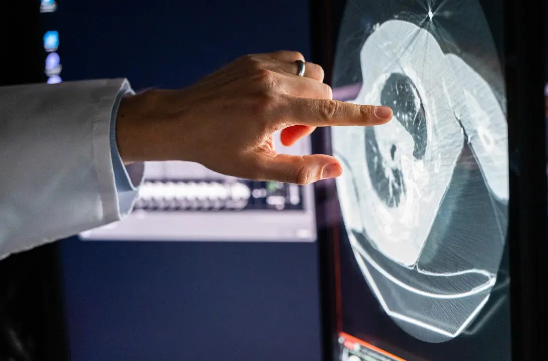 Terapia dirigida vs inmunoterapia para el cáncer