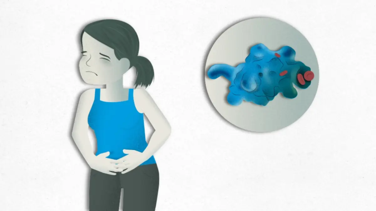 La pediatra Luly Gil aborda la ameba: claves para su prevención y detección