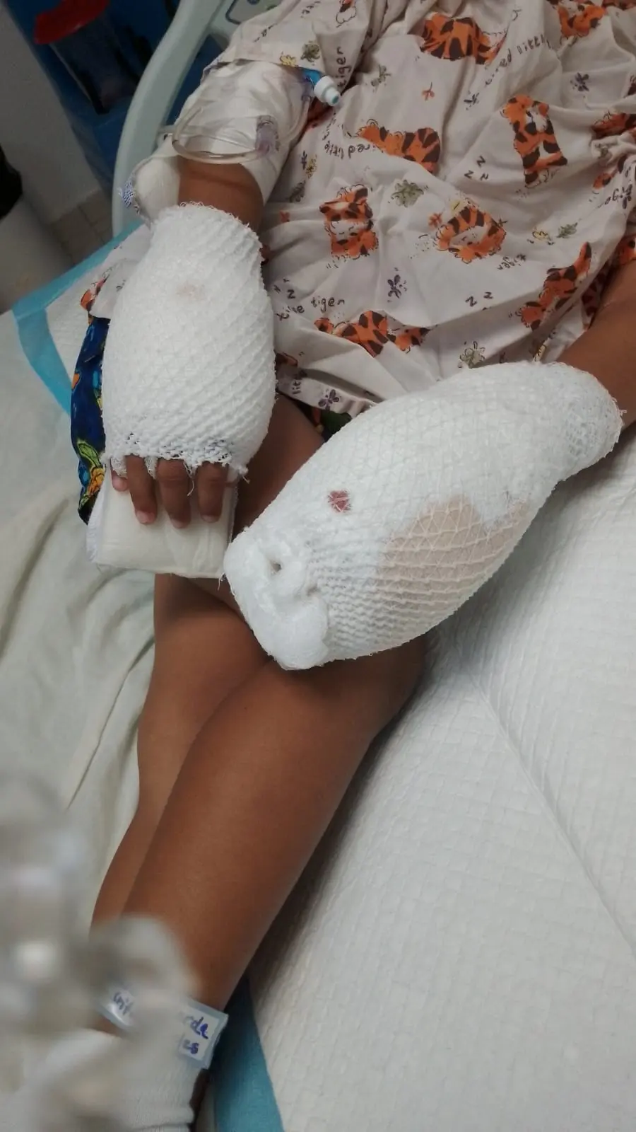 Conocerán este lunes medida de coerción contra mujer acusada de quemar las manos a su hijo de 4 años