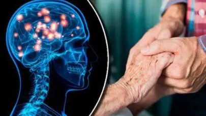 La lucha contra la enfermedad de Huntington: entre el estigma social y la esperanza en la ciencia