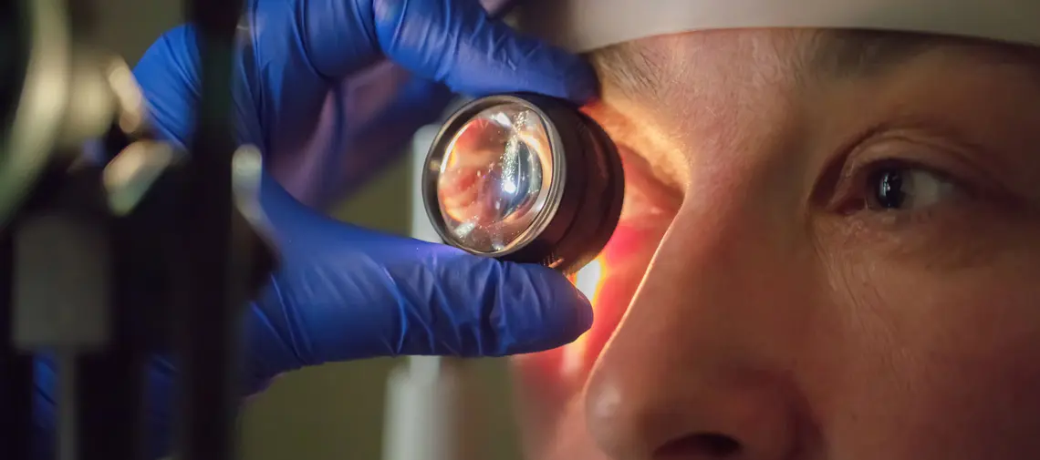 Glaucoma, el ladrón silente de la visión: La importancia de la detección temprana y la prevención