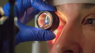 Glaucoma, el ladrón silente de la visión: La importancia de la detección temprana y la prevención