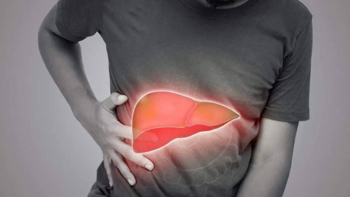 Relación entre el hígado graso y la mortalidad mantiene en alerta a especialistas