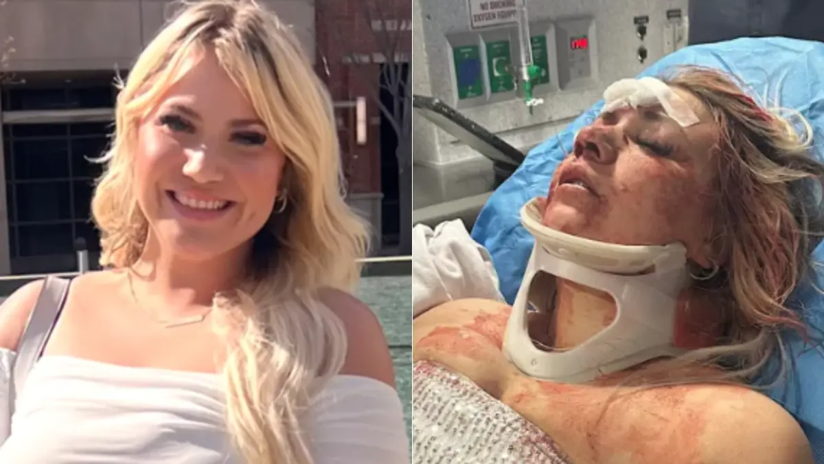 Futura novia es brutalmente atacada durante su despedida de soltera en Dallas