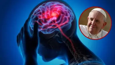 Lo que debes saber sobre el ictus cerebral, la causa de muerte del papa Francisco