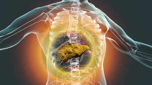 Un estudio vincula el consumo de alcohol con una mayor incidencia del cáncer de páncreas