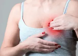 La Consulta: Fibroadenomas de mama, síntomas y tratamientos