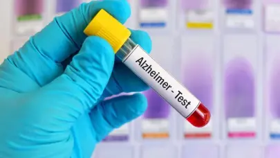 EE.UU. aprueba el primer test sanguíneo para ayudar en la detección del alzhéimer
