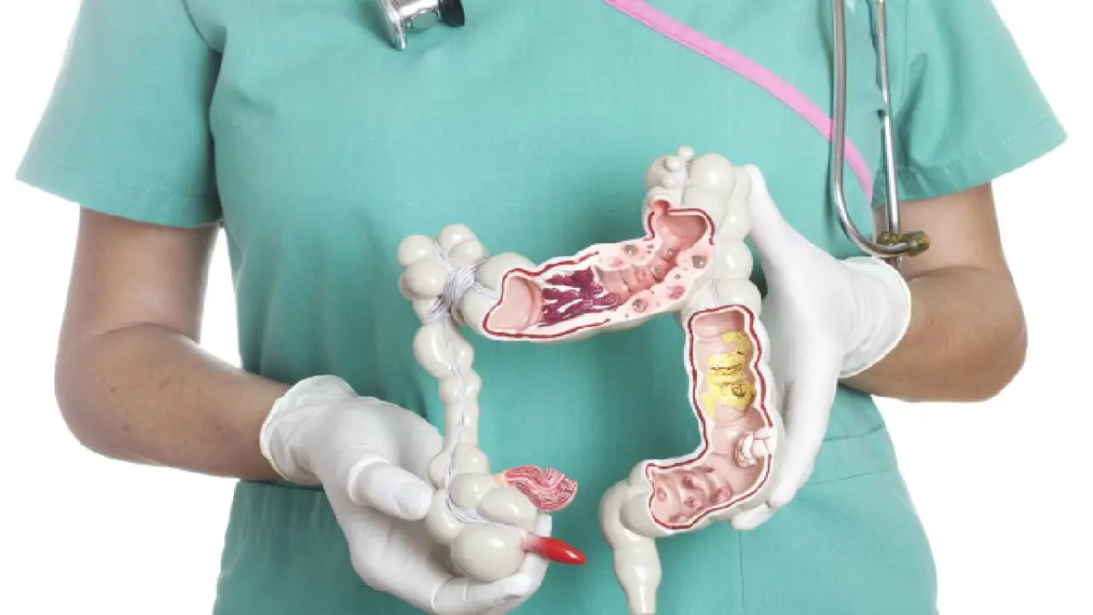 ¿Alguna vez te has preguntado qué dicen tus heces sobre tu salud?