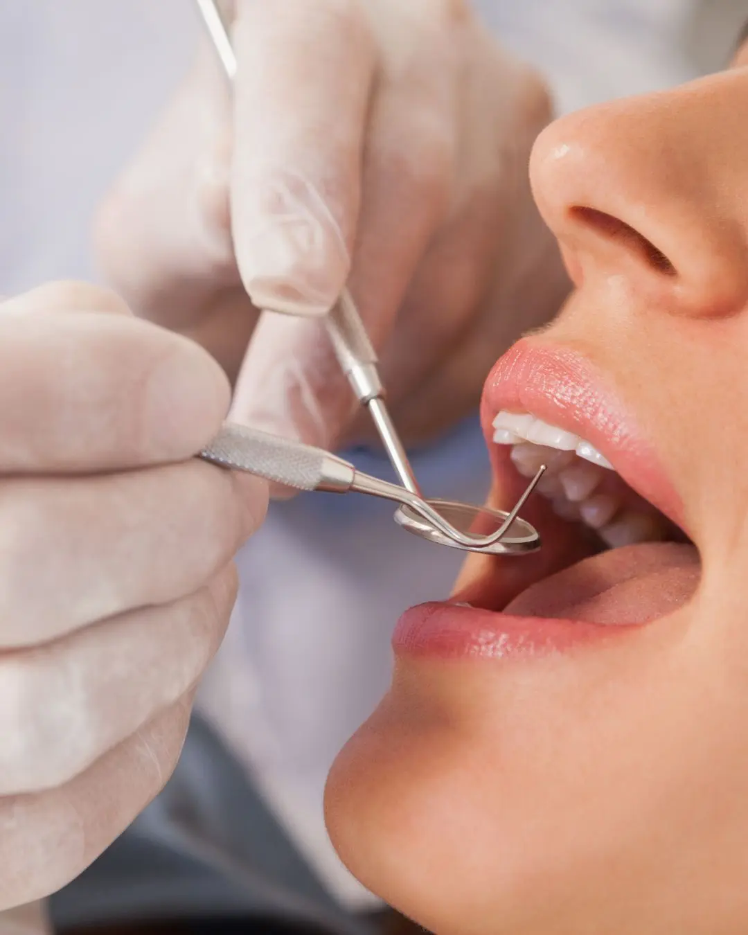 La cirugía oral: clave para recuperar la confianza en la sonrisa y proteger la salud bucal