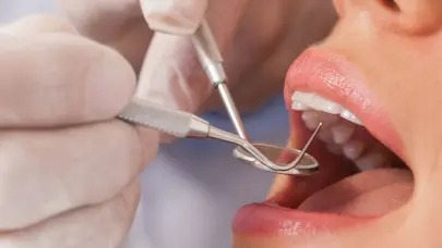 La cirugía oral: clave para recuperar la confianza en la sonrisa y proteger la salud bucal