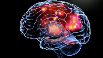 Aumentan casos de epilepsia en RD