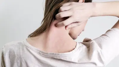 Dermatólogos advierten del impacto que el cambio climático tiene en la salud de la piel