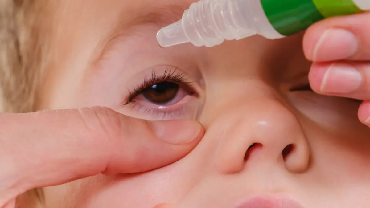 Conoce qué es la conjuntivitis alérgica y bacteriana en el infante, y cómo tratarlas