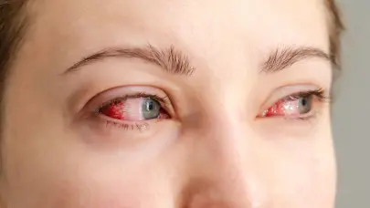 ¿Te arden los ojos? El polvo del Sahara y el calor podrían ser los culpables