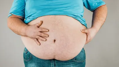 Identifican una proteína que mejora el control de obesidad y enfermedades cardiovasculares
