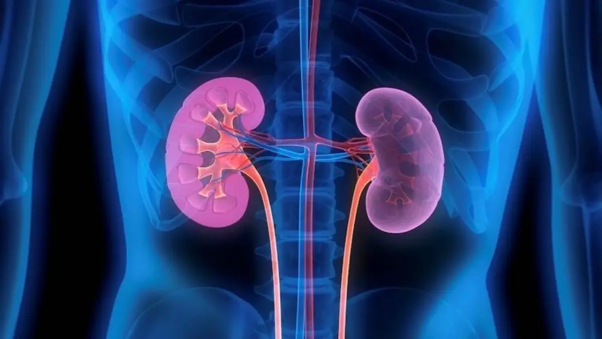 Avances médicos y factores de riesgo: una mirada al panorama actual del cáncer renal