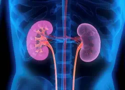 Avances médicos y factores de riesgo: una mirada al panorama actual del cáncer renal