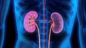 Avances médicos y factores de riesgo: una mirada al panorama actual del cáncer renal