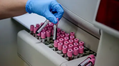 Confirman la extensión global de un gen que crea bacterias resistentes a los antibióticos