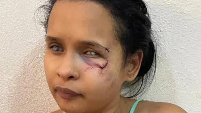 Mujer no vidente denuncia agresión por parte de su pareja en Jayaco La Ceiba