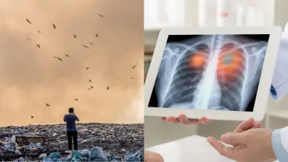 El ADN revela la conexión entre la contaminación y el cáncer de pulmón en no fumadores, según estudio