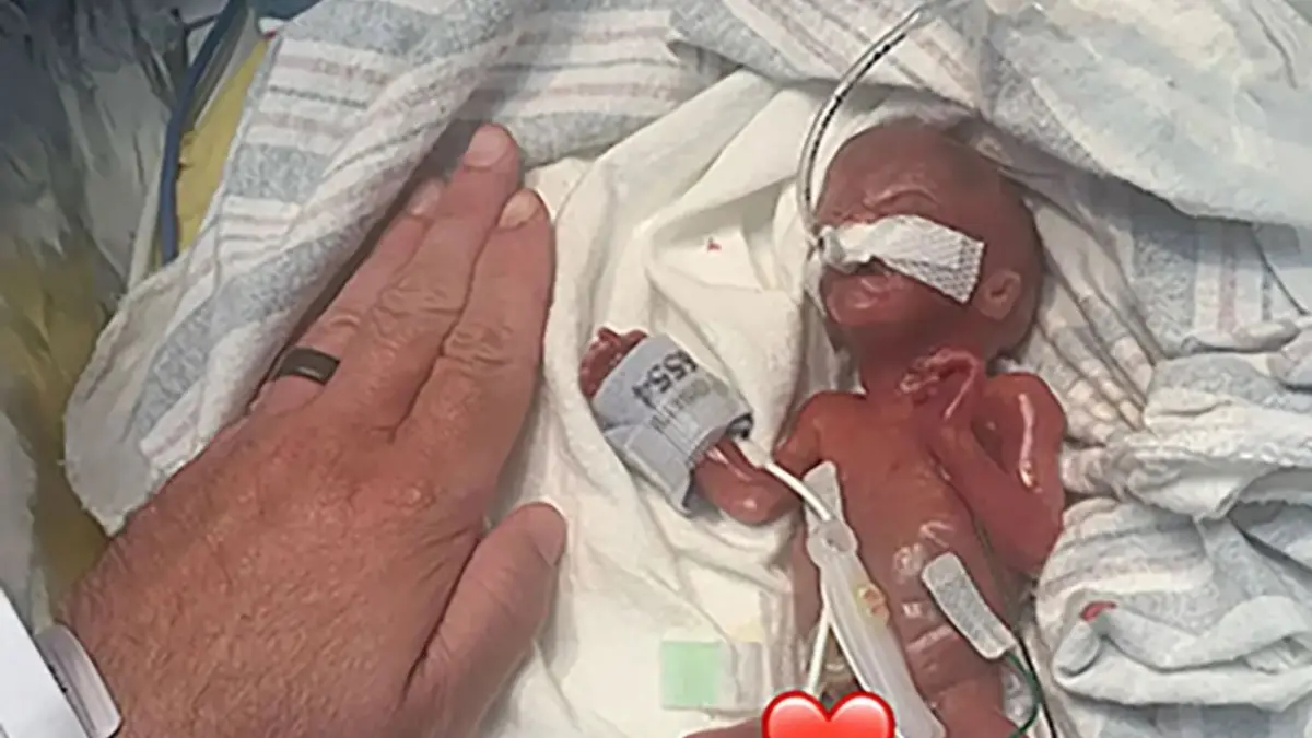 Nació a las 21 semanas y venció todo pronóstico: el bebé más prematuro del mundo celebra su primer cumpleaños
