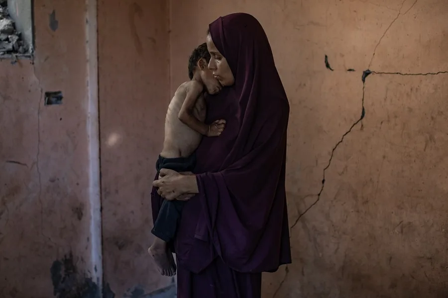 La desnutrición en Gaza mata a 86 personas, la mayoría niños, desde el inicio de la ofensiva israelí