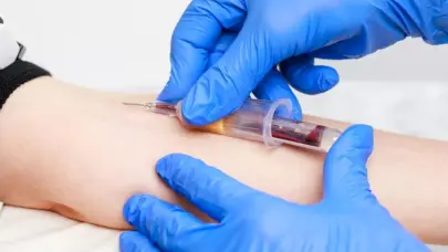 Identifican 250 proteínas en sangre que pueden revelar la gravedad de la malaria