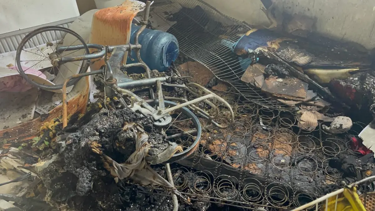 Dos niños con quemaduras graves tras incendio en vivienda de Hato Mayor, Santiago