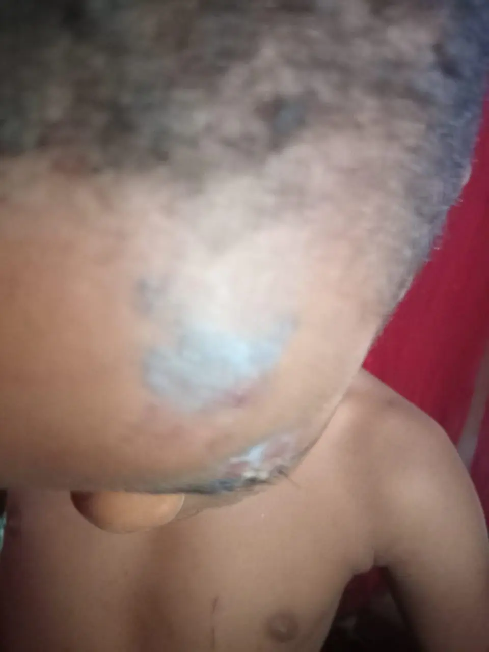 Niño de 4 años resulta herido tras ser arrollado por un caballo en Sabana Grande de Boyá
